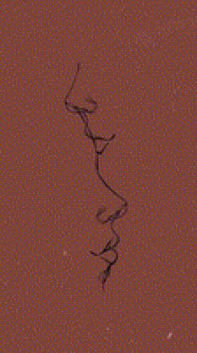 губы - эстетика - предпросмотр