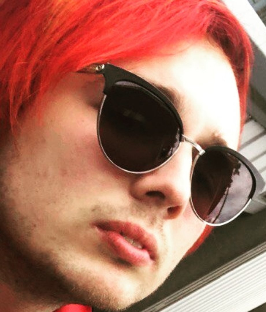 Даун на минималках - даун, дцп, аутизм - оригинал